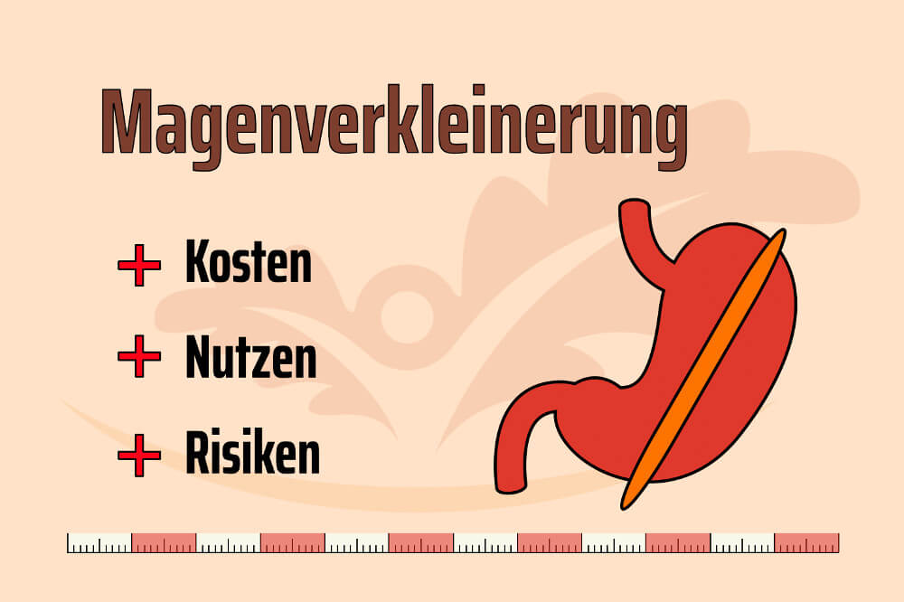 Magenverkleinerung Türkei / Antalya Kosten